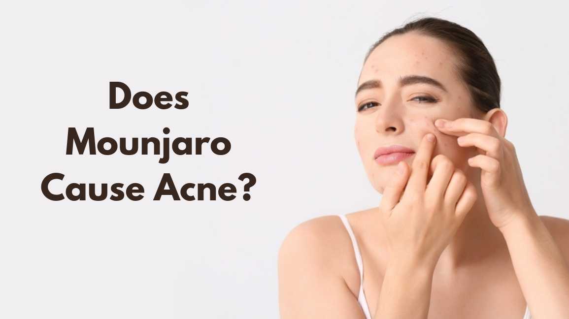 Does Mounjaro Cause Acne